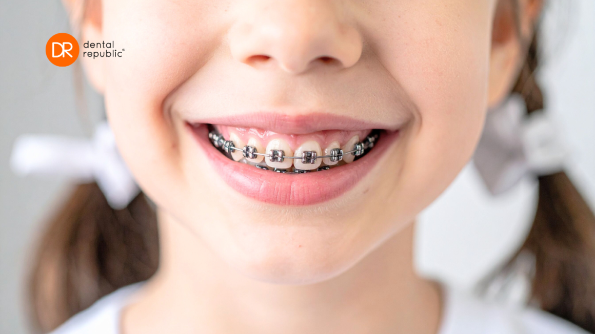 Ortodonta Toruń – aparat dla dziecka Ortodonta Toruń – aparat dla dziecka