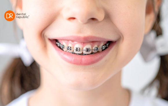 Ortodonta Toruń – aparat dla dziecka
