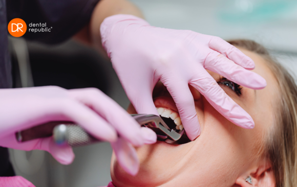 Usuwanie ósemek Toruń Usuwanie ósemek Toruń